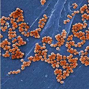 Genome Res：：：全基因组测序追踪耐药细菌撒播机制